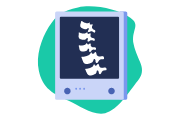 spondyloarthrite axiale